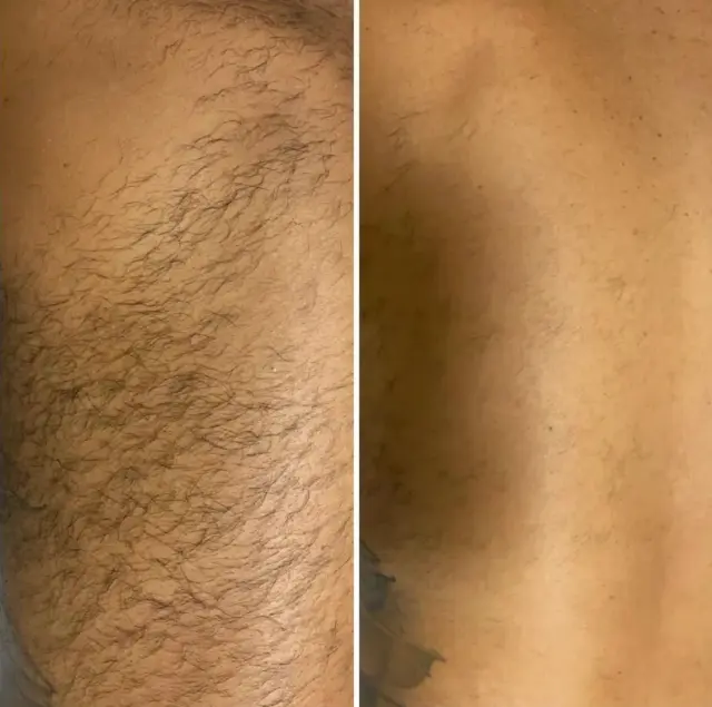 Essenza della Bellezza - Centri Estetici a Genova (4)