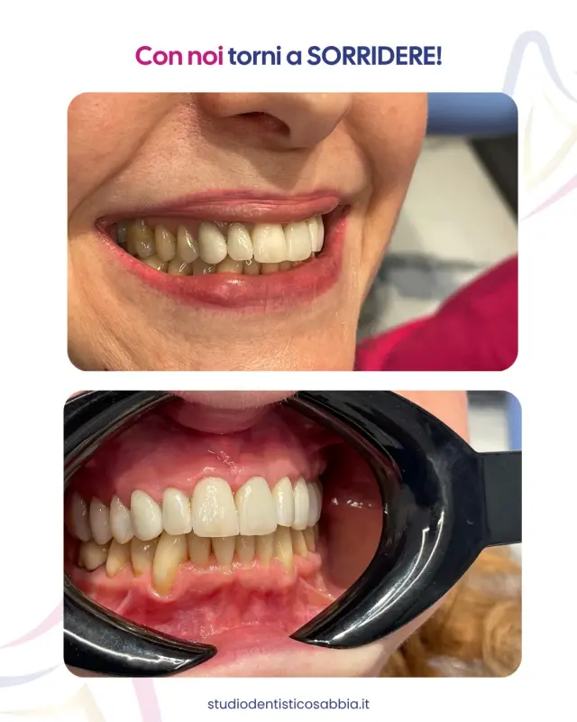 Studio Dentistico Sabbia - Dentisti a Genova (6)
