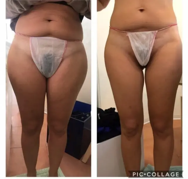 Aqua Estetica e Benessere - Centri Estetici a Genova